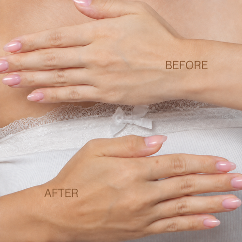 Pixi GradualGlow sunless tanner Before and After view shown on hands. view 2